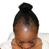 Delaina-before