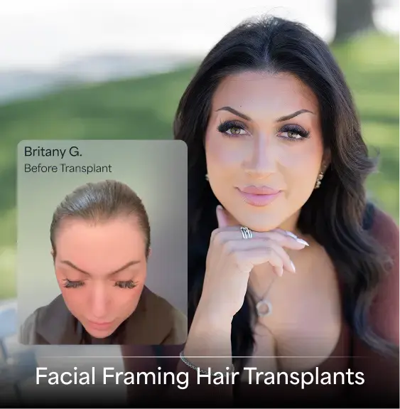 Facial Framing