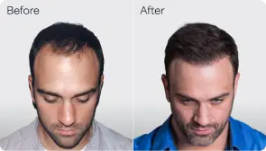 Jeff B.-before-after