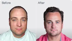 Joshua A-before-after