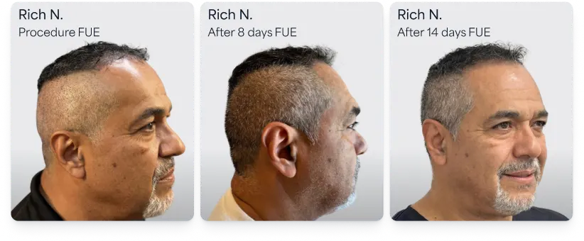 Whole Head